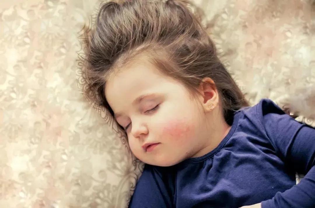 宝宝的脸干燥起皮发红有小疹子,过敏起皮泛红