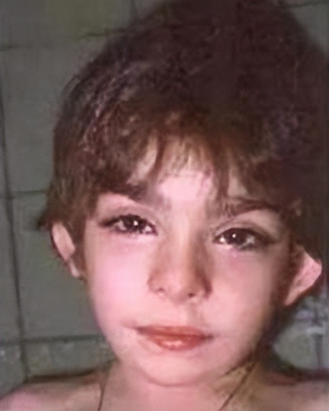 关注罕见病的视频,歌舞伎综合征是什么意思