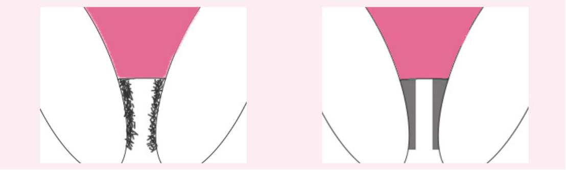 *处私**的毛发为什么是卷的？可以刮掉吗？答案在这里，看看不吃亏