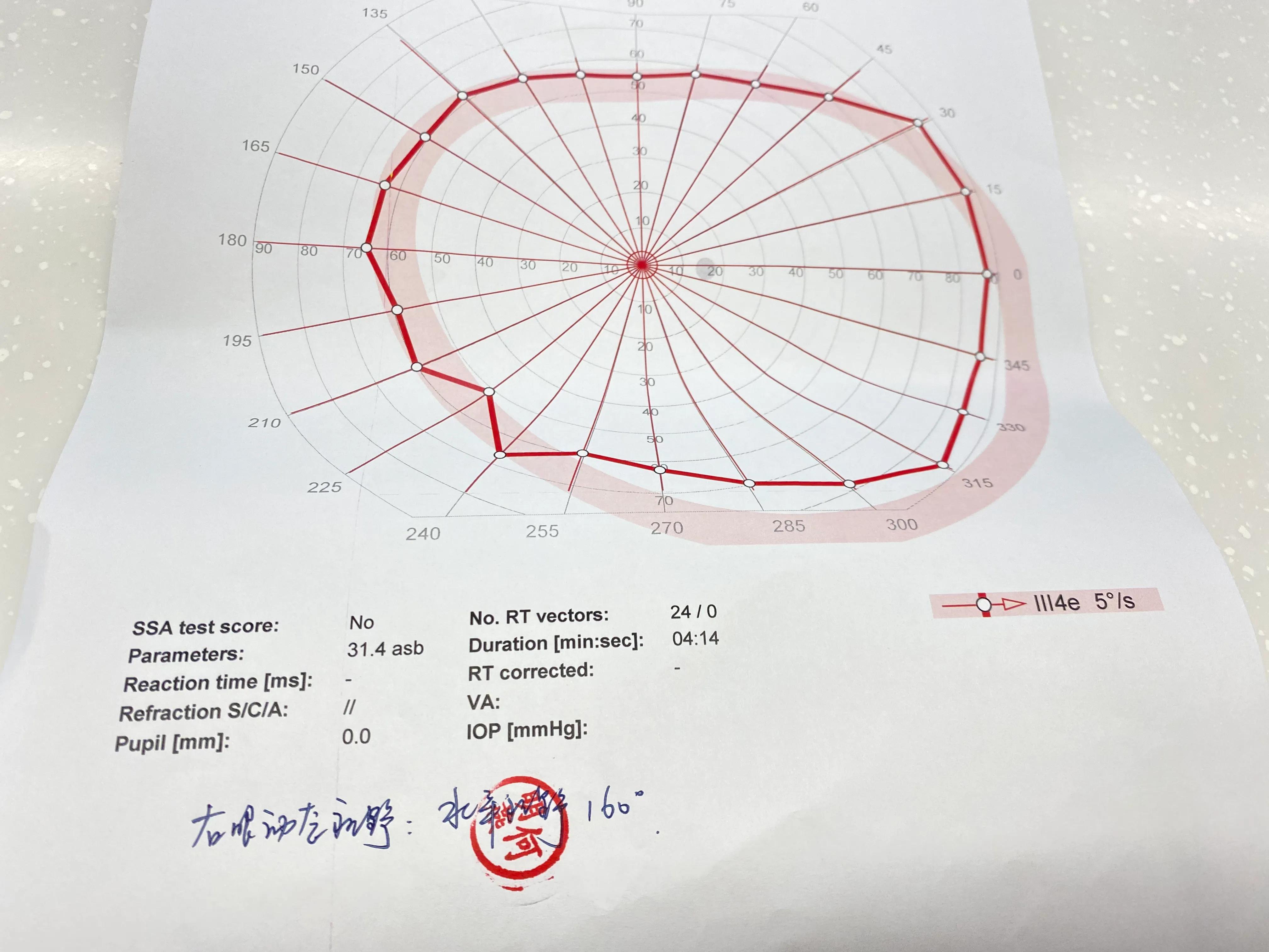 北京单眼视力考驾照流程,北京大学第三医院单眼体检