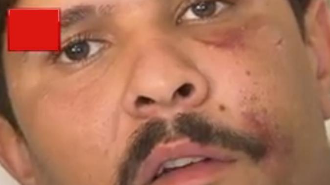 普通人能徒手打得过袋鼠吗？2018年，野生袋鼠一脚踢碎挡风玻璃