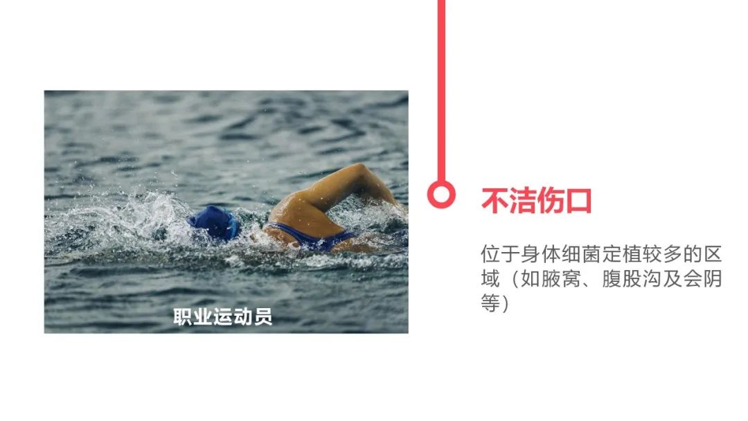 容易患破伤风的危险因素,什么样的人最适合得破伤风