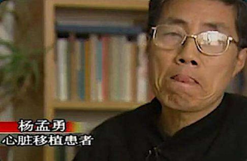 老汉移植小伙心脏性情大变,2000年老汉移植小伙心脏