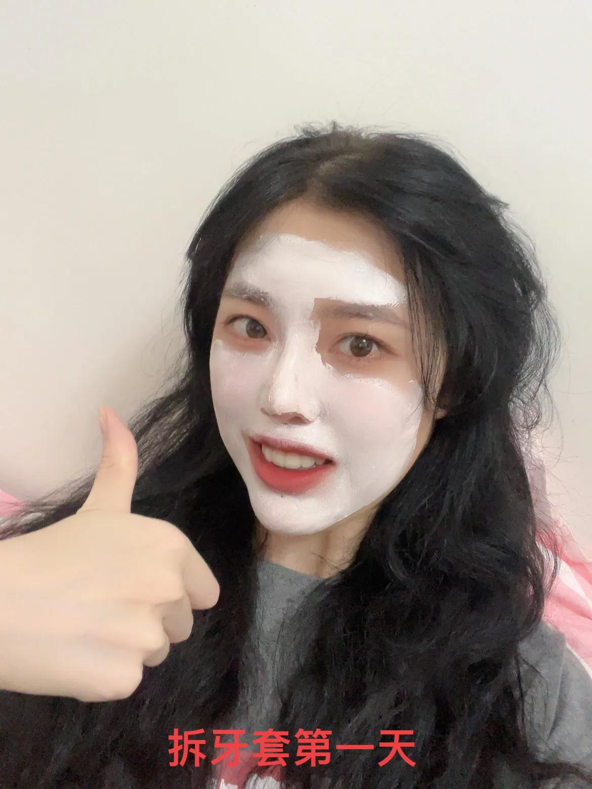 牙齿矫正需要多少钱呢前后对比图,牙齿矫正最多需要多少钱