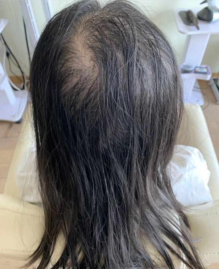 修正防脱固发洗发露评测,哪几款洗发露最好用不会秃头