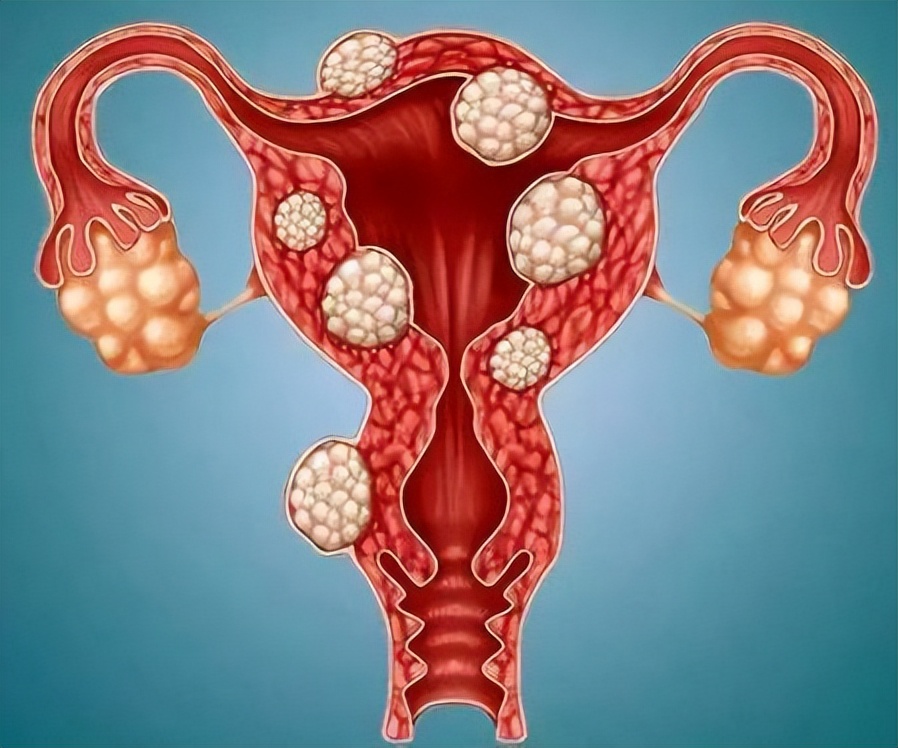 绝经不一定是坏事！妇科主任：绝经后，三个健康问题或悄悄退出