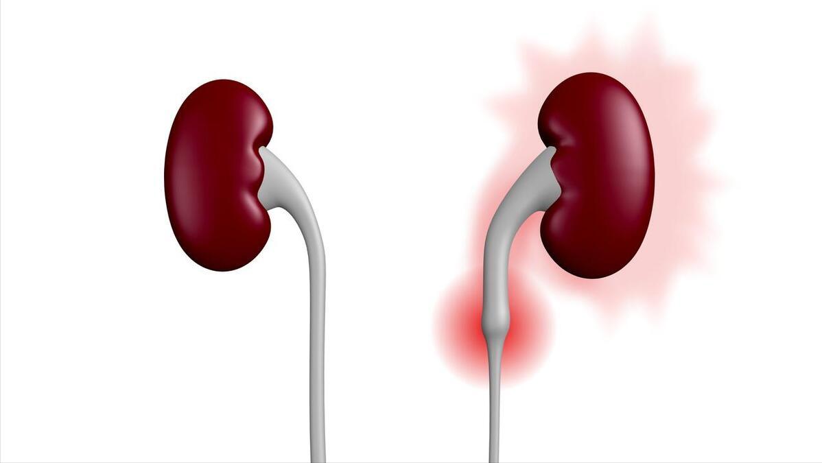 四种药对肾脏的影响,降低肾肌酐最好药是什么