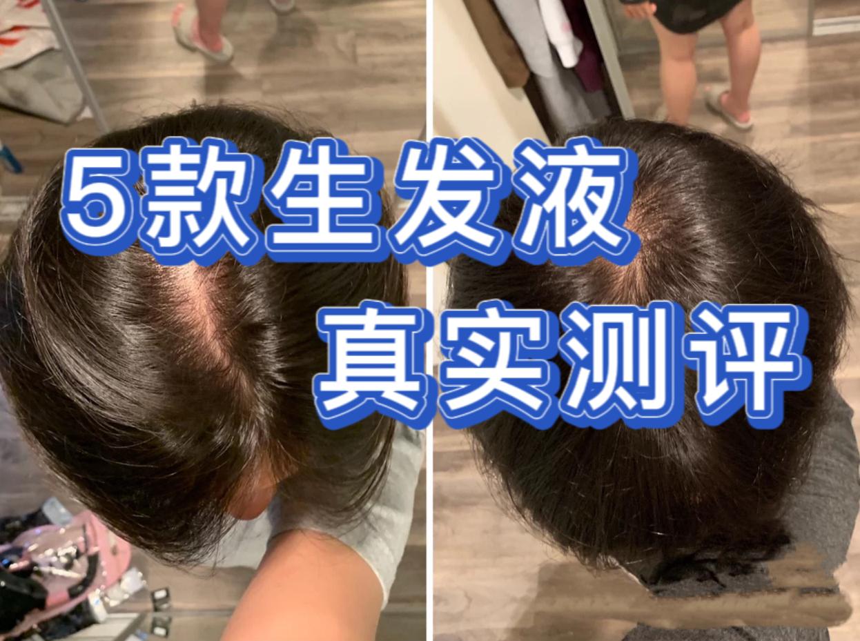 推荐一款最好的生发液,男士生发液真实测评