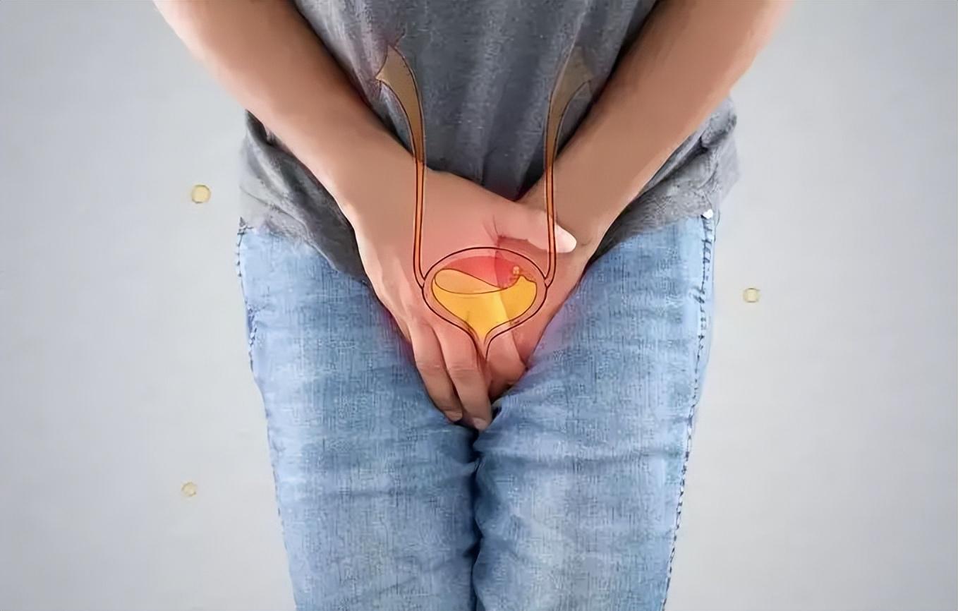 尿路感染有5种征兆,尿路感染有什么症状会有蛋白尿吗