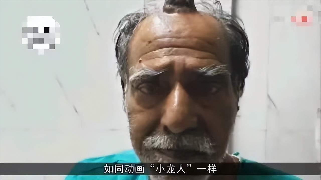 头上长角的长寿老人,107岁老人头上有个长犄角