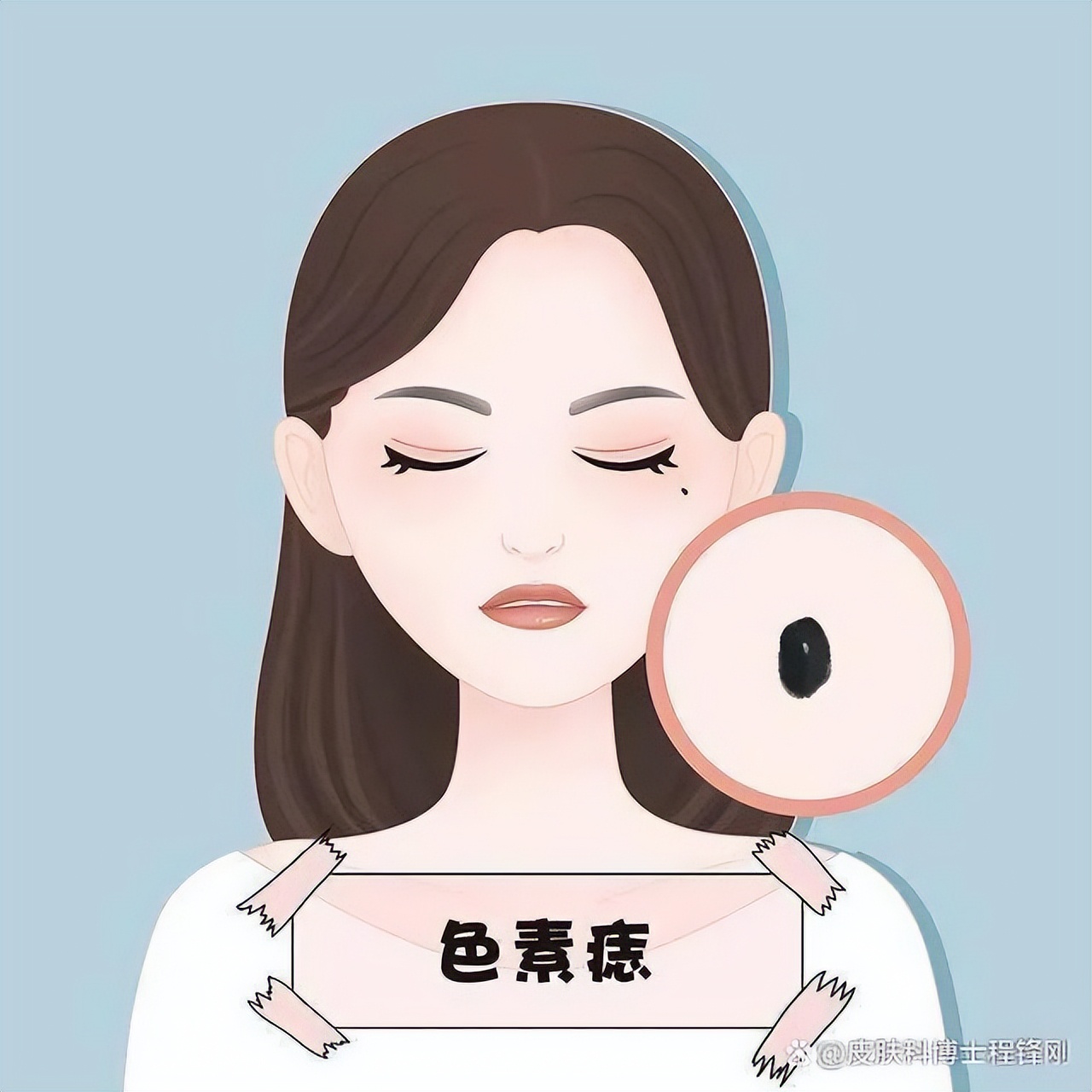 祛痣了怎么会长出肉疙瘩,祛痣之后长出了红痘还能好吗