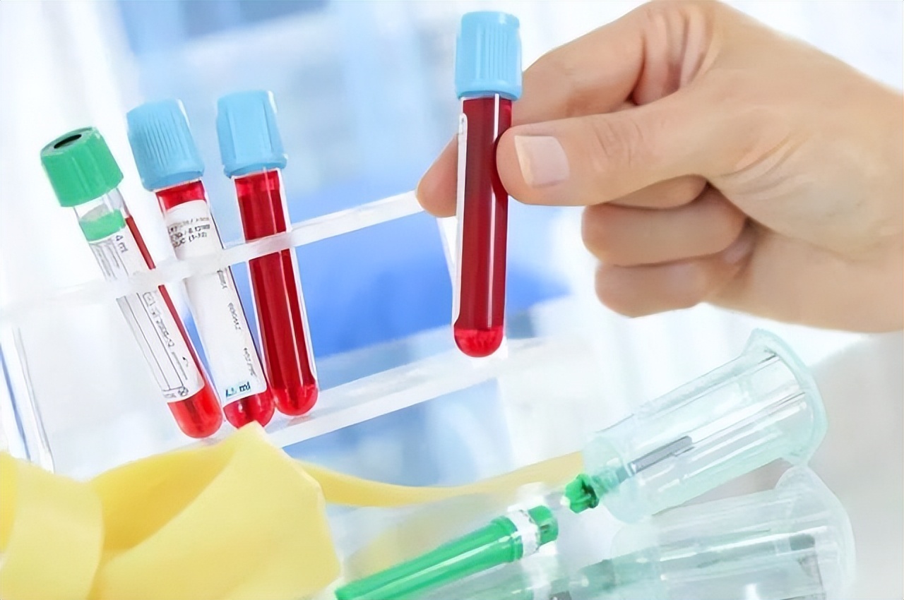 血常规四个指标升高需要注意什么,血常规检查之后才看哪三项