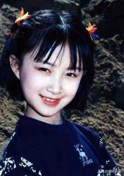 那些整容失败的女星你还记得哪些,盘点整容失败惨不忍睹女星