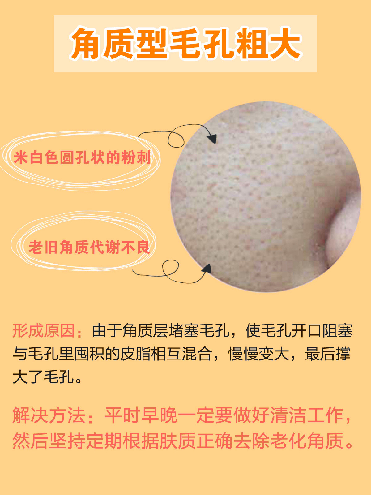 毛孔粗大也有办法改善皮肤科普,毛孔粗大最全攻略解决办法