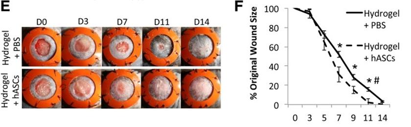 全球干细胞最新临床进展,干细胞再生医学现状