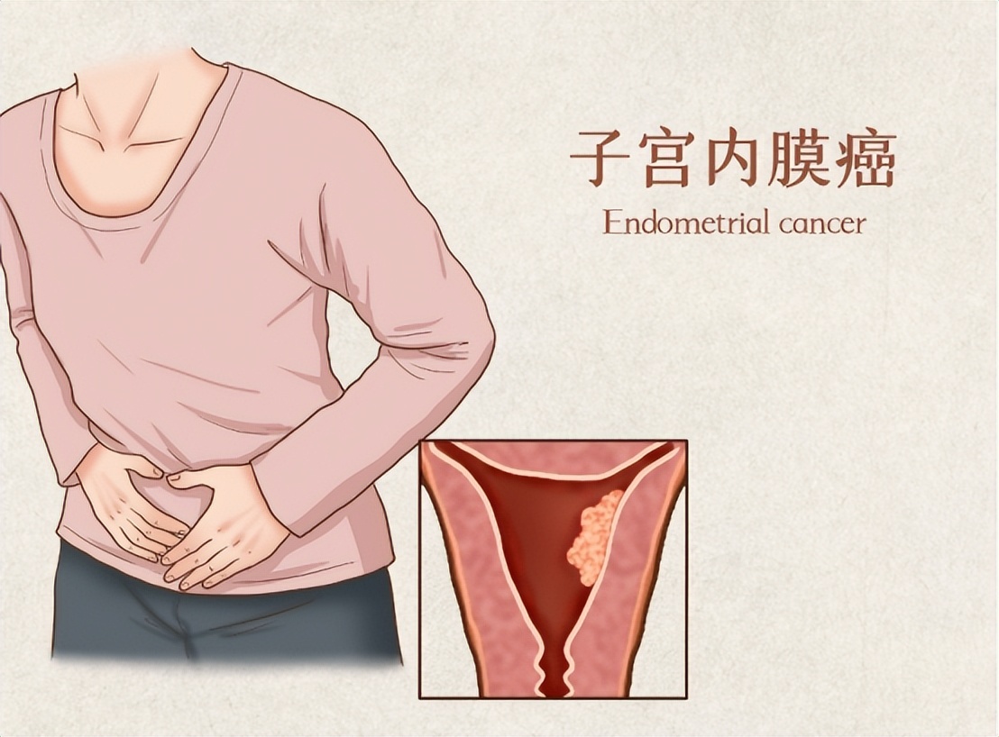 子宫性不孕要如何诊断,查不孕不育查出宫颈病变