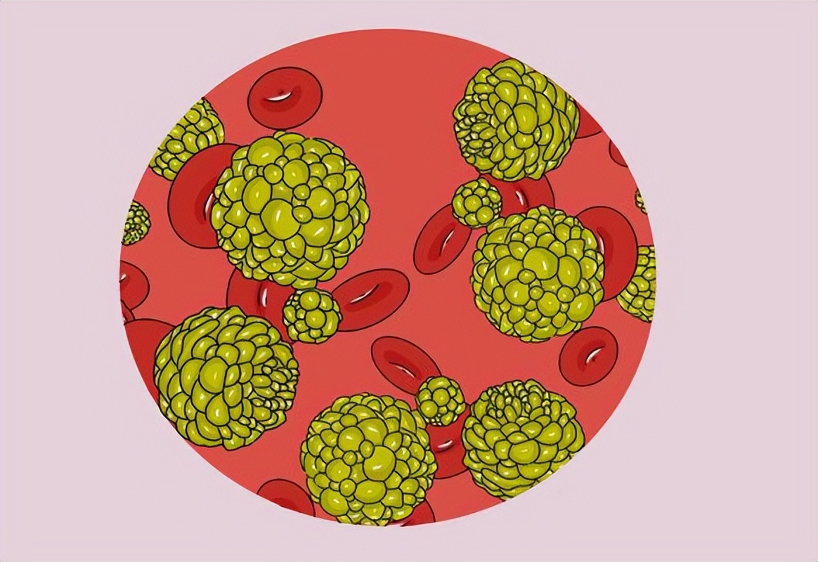 结节散结处方,散结结节中药方