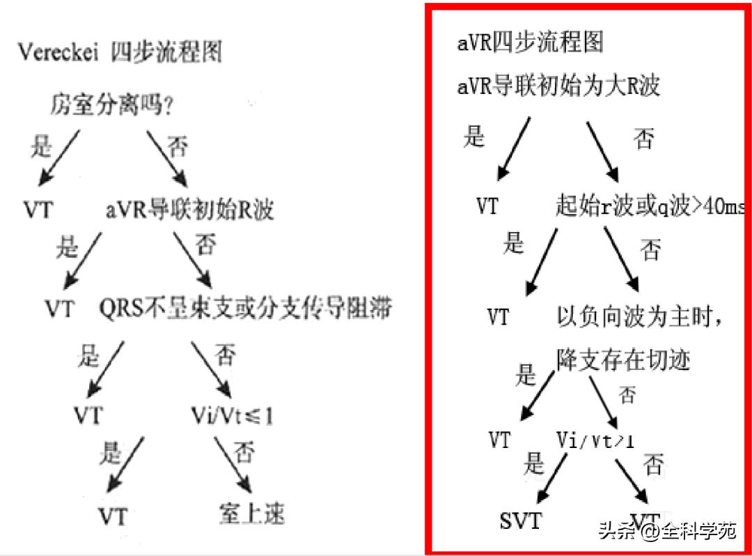 心电图上表现为宽qrs波,心电图中qrs是代表心动过速吗