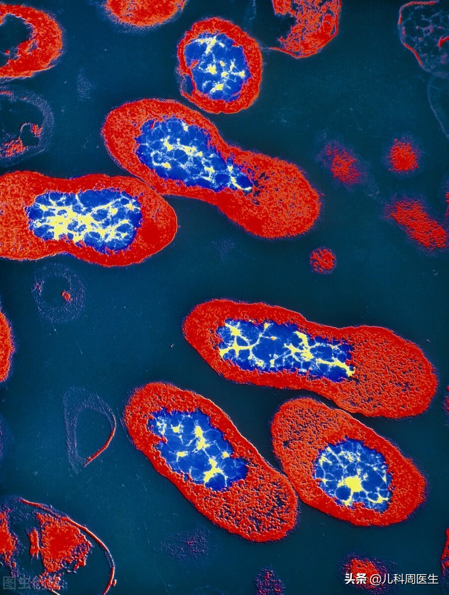 儿童肺炎咳嗽没有痰的声音,喉咙嘶哑咳嗽是不是肺炎症状