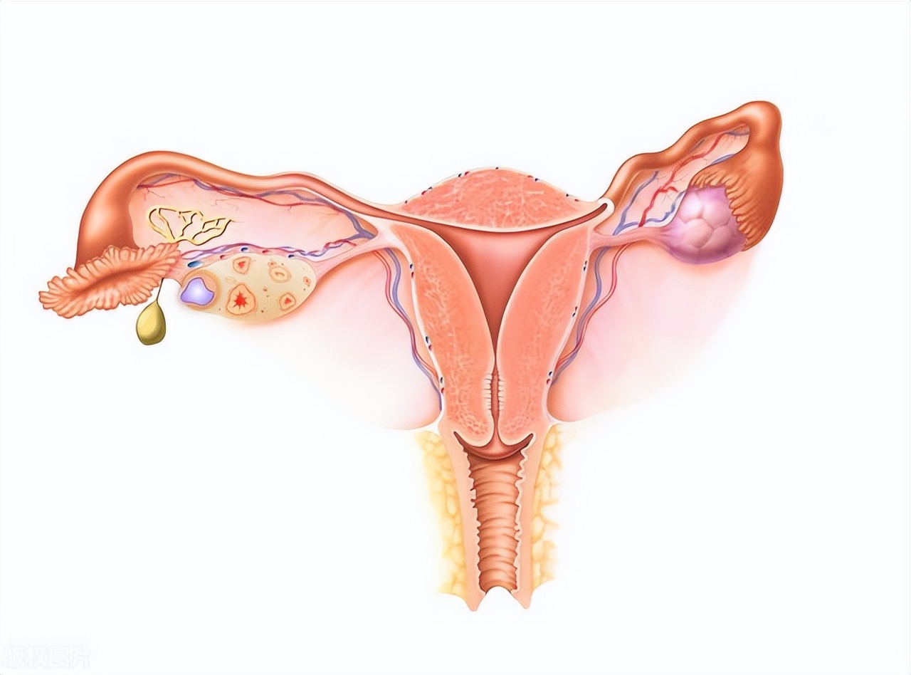 女人倒开花是什么病,老年人绝经后倒开花的三种表现