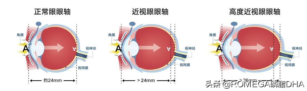 长期戴防蓝光眼镜对眼睛有影响吗,经常戴眼镜眼睛有什么变化吗