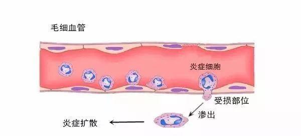 痘痘一直好不了变硬皮,痘痘一直好不了伤口溃烂