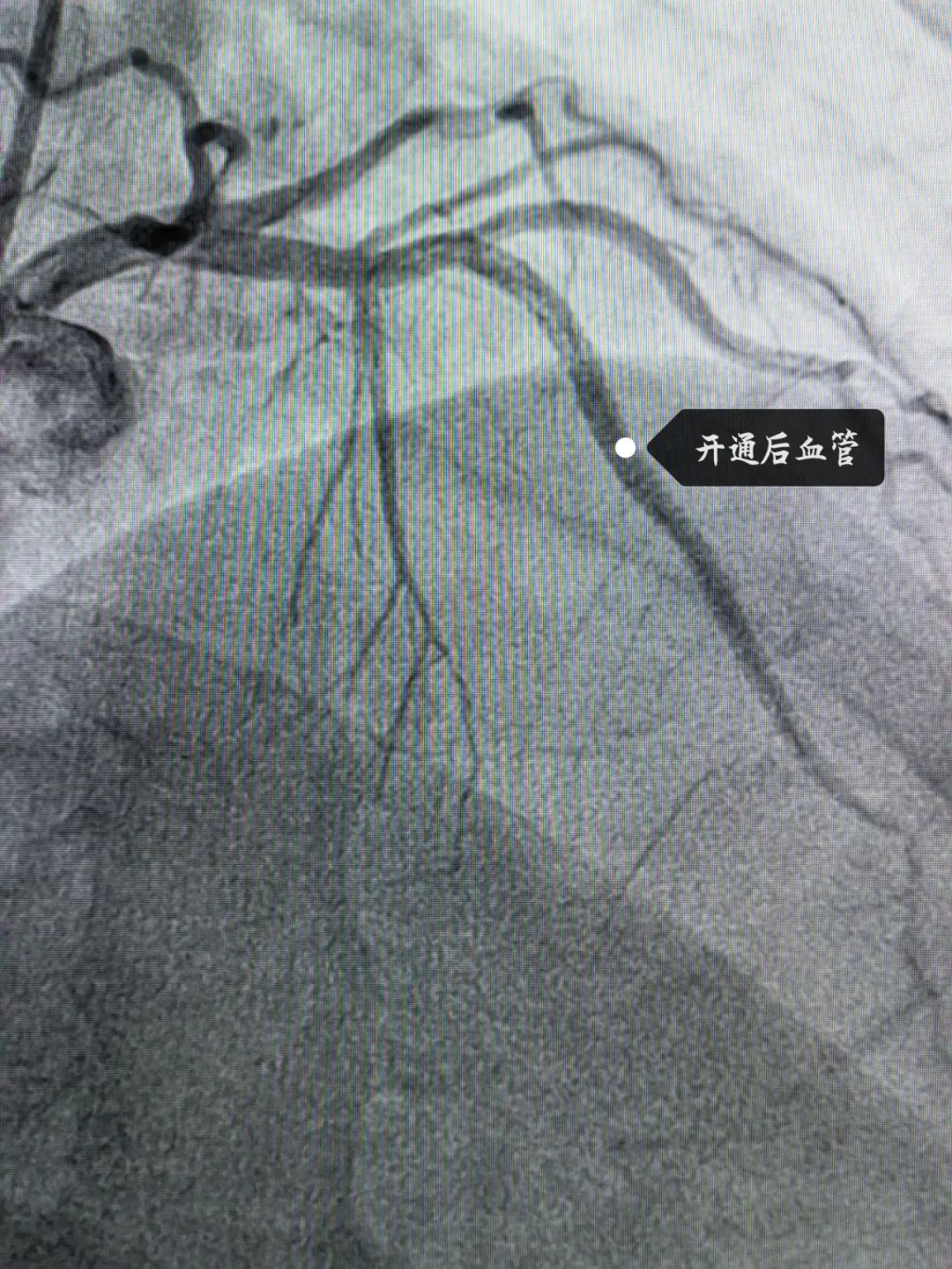 南昌最好的医院心血管内科,南昌一附院心血管内科怎么样