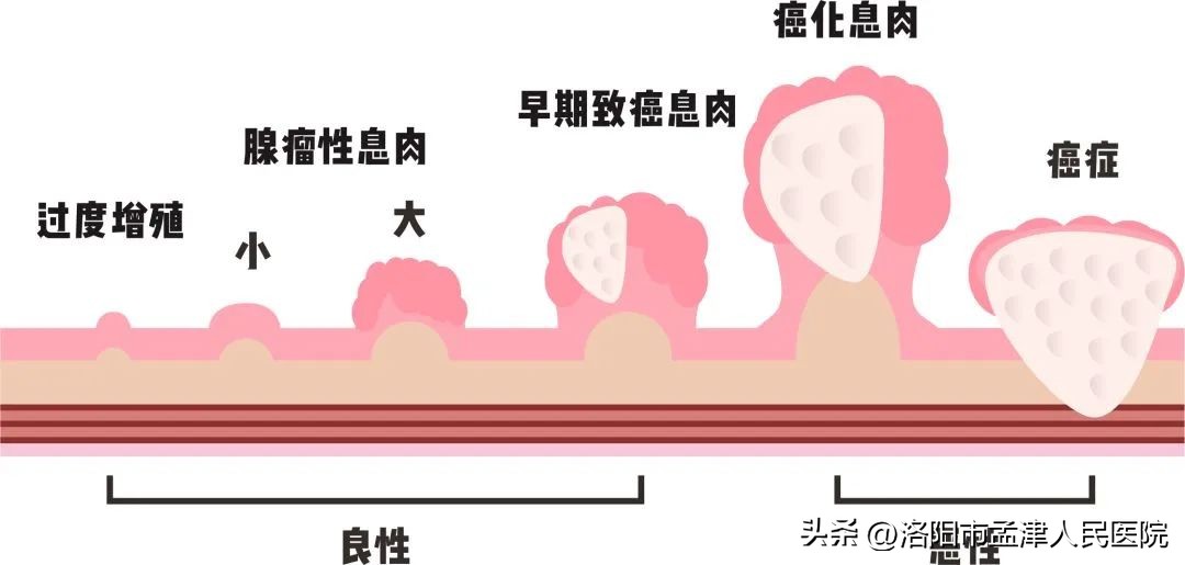 奥林巴斯290内镜系统介绍,奥林巴斯290电子胃肠镜介绍