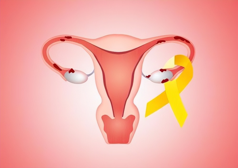 糟蹋子宫的四种坏习惯,糟蹋子宫的几个坏习惯