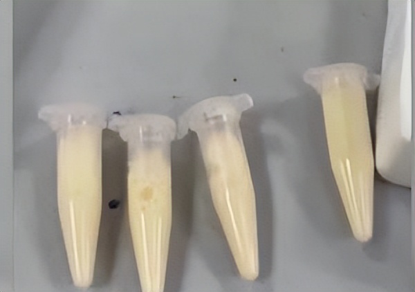 孕期喝一杯奶茶对胎儿有影响吗,孕期喝奶茶真正不能吃的东西