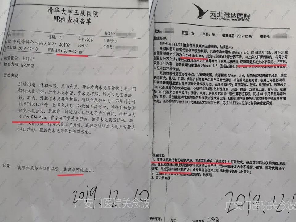 正确使用中医药治疗肿瘤才显效,关于中医中药在肿瘤治疗中的见解