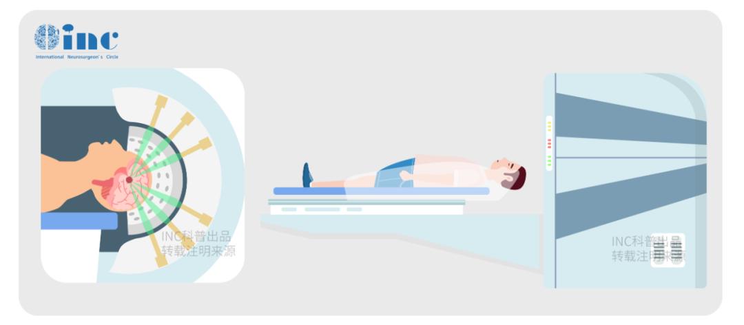 儿童脑瘤放疗后可以走吗,小孩脑瘤手术后放疗能活多久