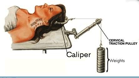 儿童落枕最快恢复办法,落枕了30秒自愈方法儿童