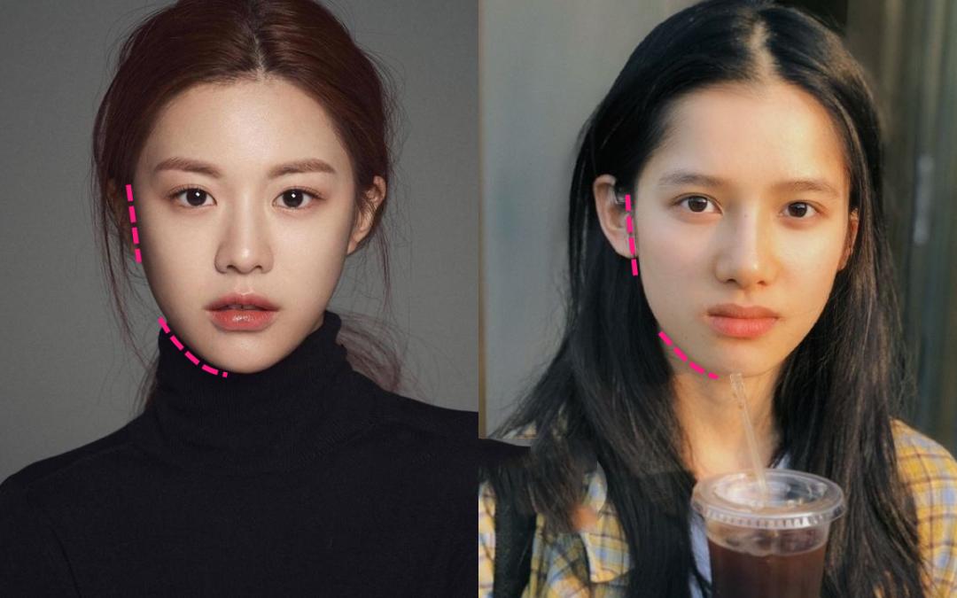 为什么大部分亚洲人都是扁头,正脸好看但侧脸丑到爆怎样办