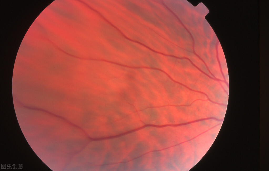 糖尿病引起脚麻吃甲钴胺吃多久,糖尿病患者手脚麻木能吃脑心通吗