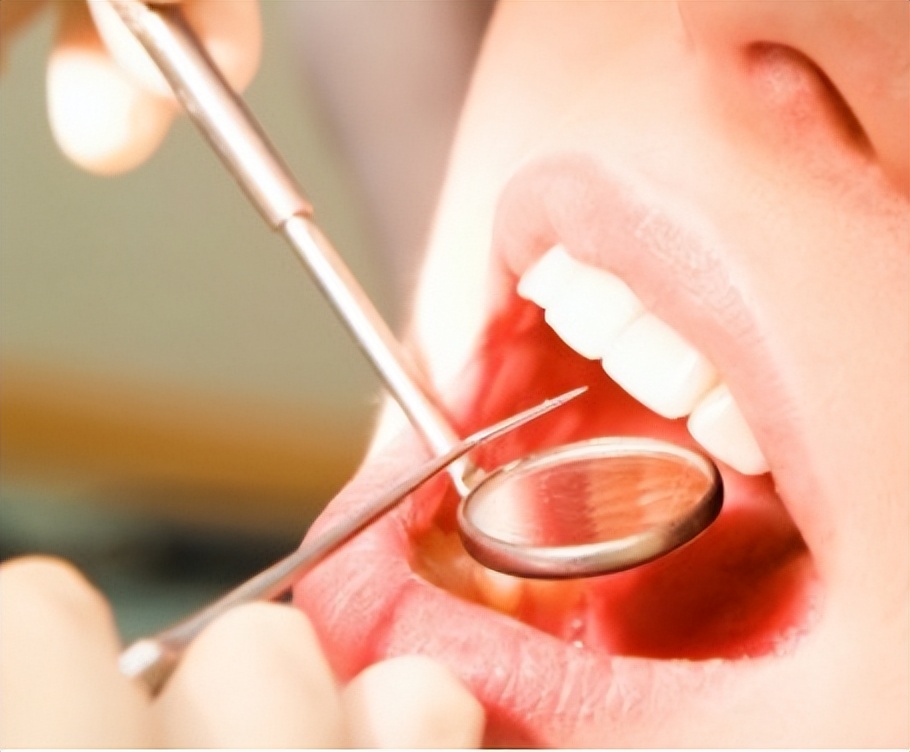 拔牙之后怎么护理口腔,拔牙后怎么护理记住这6点就够了