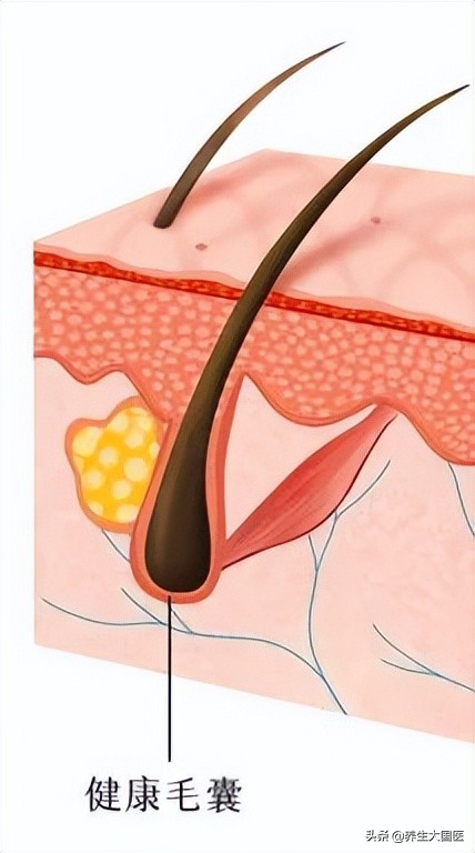 白头发是什么原因造成白发,白头发怎么调理减少白发