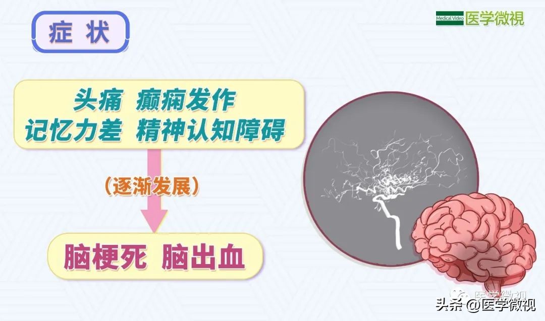 痴呆老人走失完整版,痴呆老人走失多久判定死亡