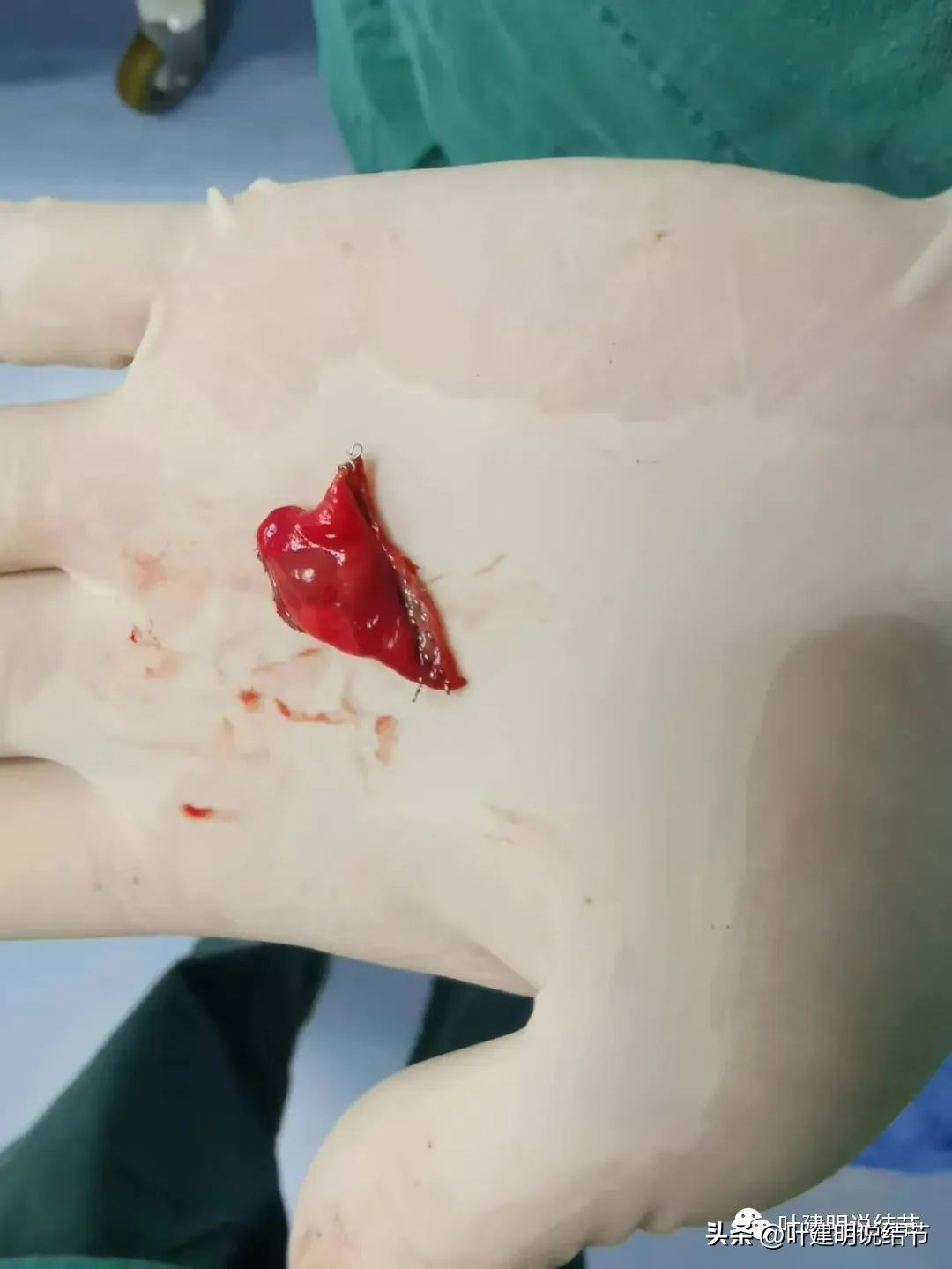 成立肺癌诊疗一体化中心,构建肺癌精准诊疗生态圈