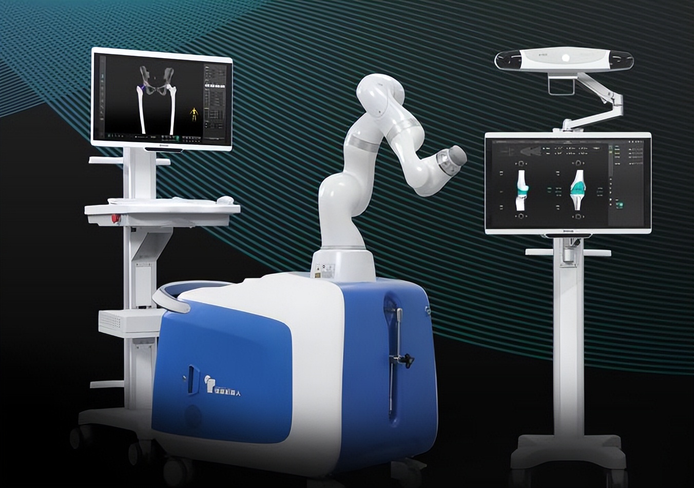 广东手术机器人2024年配置,手术机器人最新临床进展