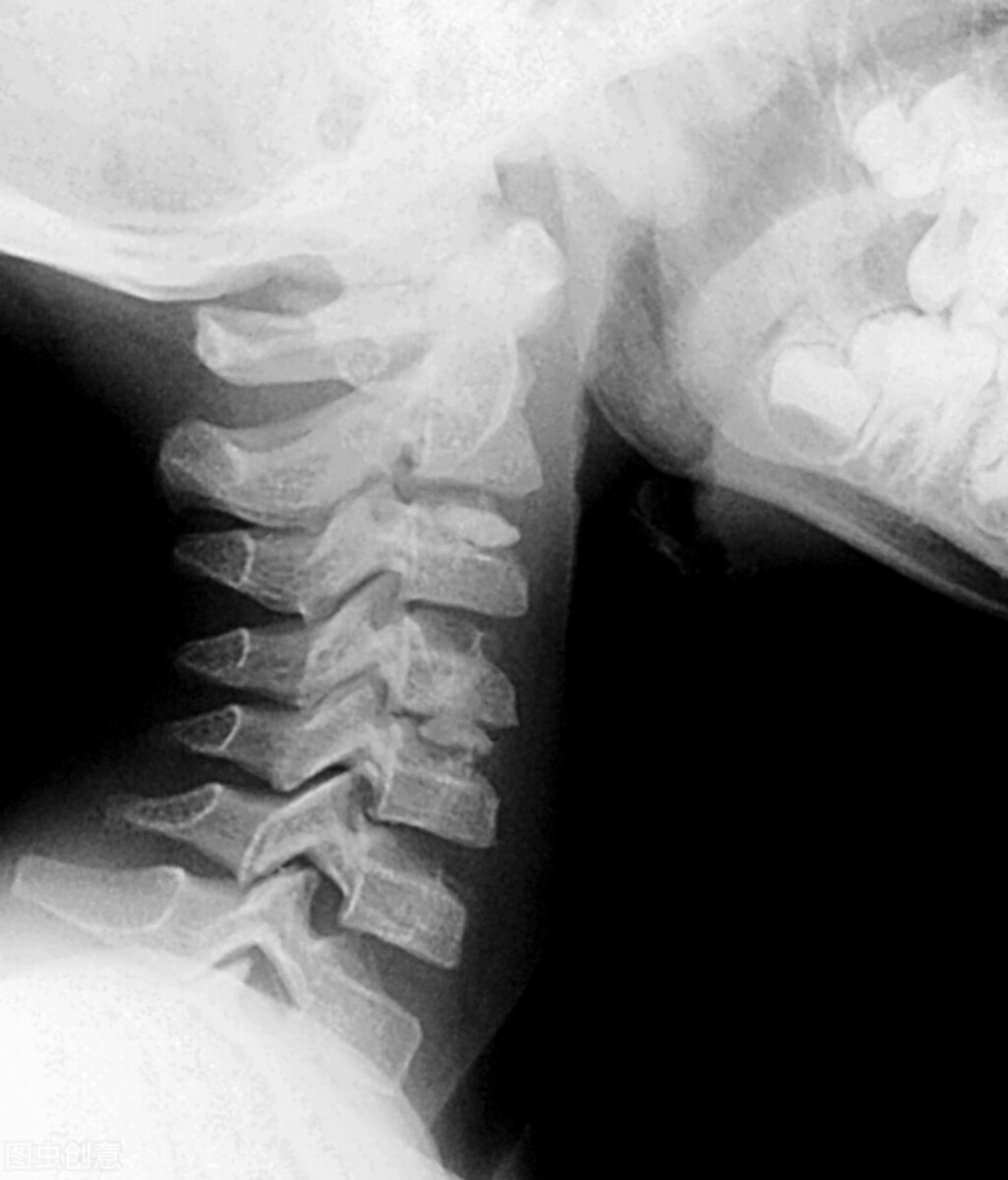 当兵的体格检查标准外科,征兵各兵种体检标准一样吗
