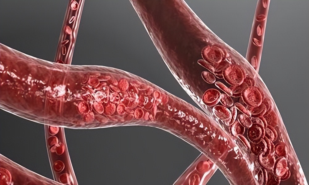 每天晚上坚持勾脚、绷脚,按一按,预防血液粘稠、缓解关节不适