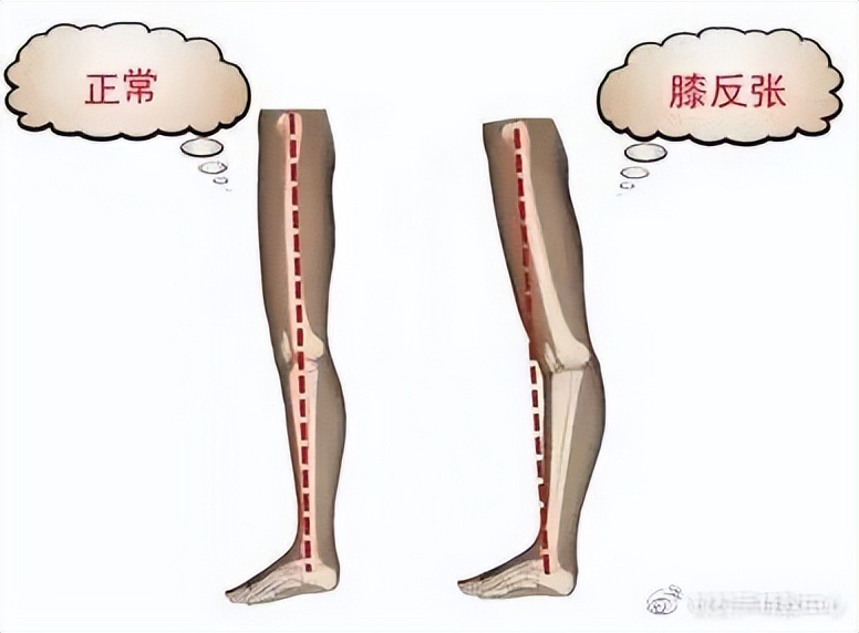 特教老师月计划,做特教老师需要具备的条件