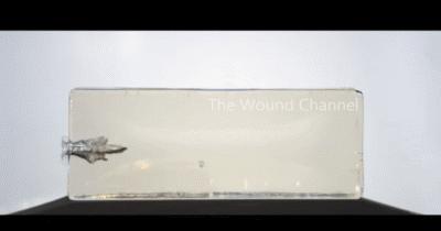 被子弹打中后怎么处理伤口,被子弹打中自己怎么处理