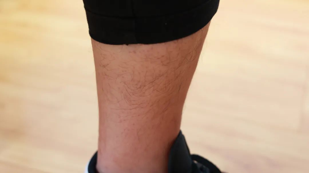 经常腿疼怎么快速缓解,经常腿痛怎么办最快最有效的方法