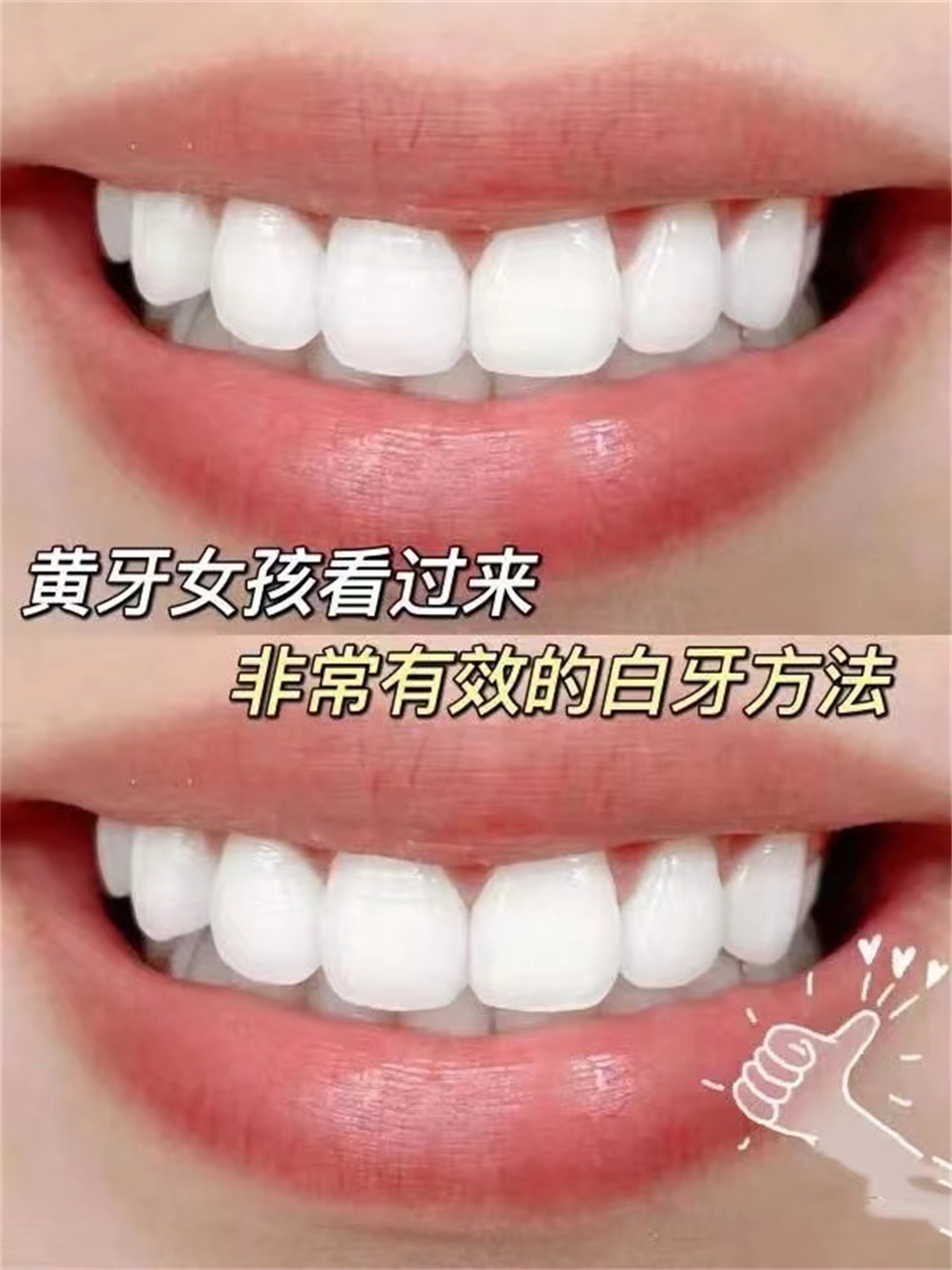 戴牙套期间能用牙粉刷牙吗,让牙齿变白的牙套贴