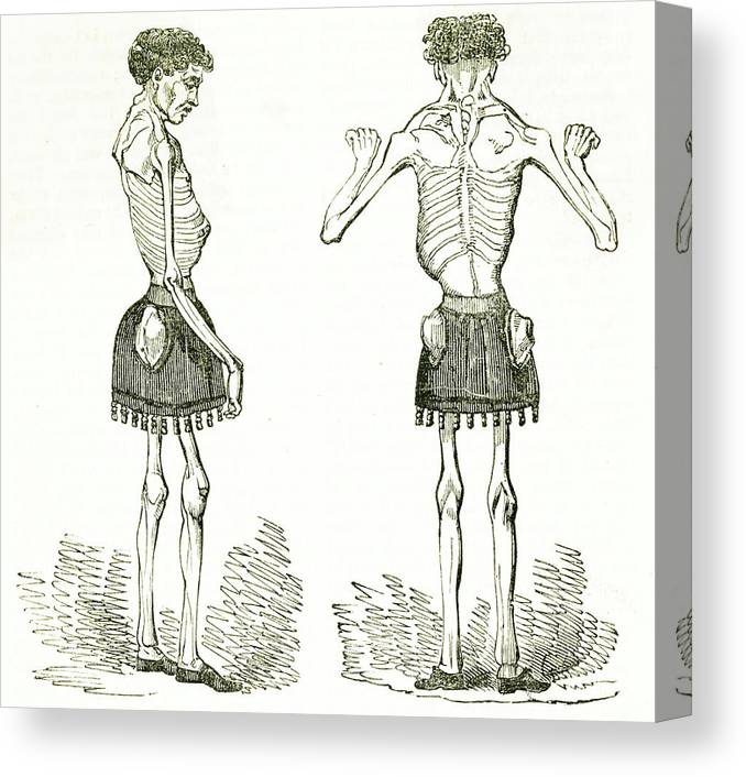 克劳德·安布罗斯·修拉：被称为“活着”的骷髅