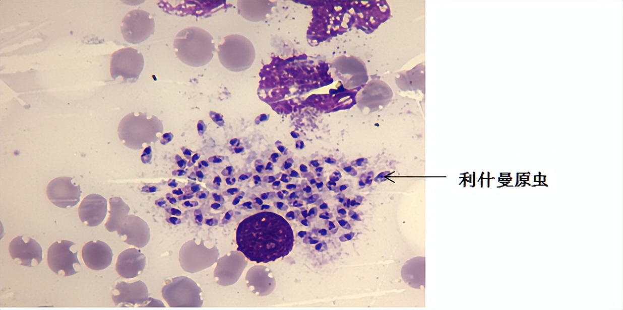 如果同时得了几种寄生虫病怎么治,现在寄生虫有哪些