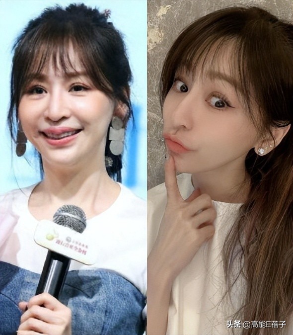 台湾艺人整形记：削骨换脸小场面，嫁给医师保修终身