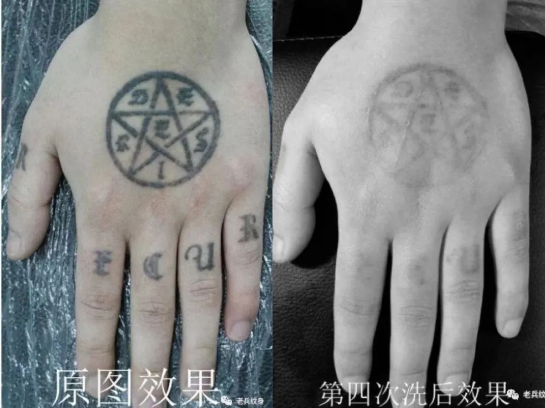 洗纹身最好的方法不留疤不留痕迹,洗纹身最好的方法不留疤不留印